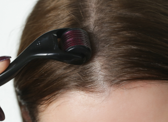 De voordelen van microneedling van het haar om hergroei te stimuleren